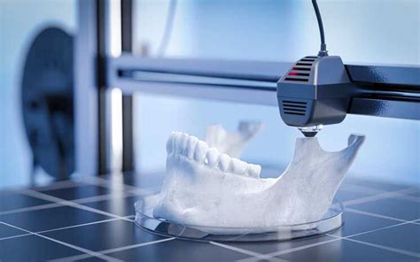 Zettle Resin：Revolutionizing Advanced 3D Printing and Personalized Medical Solutions!